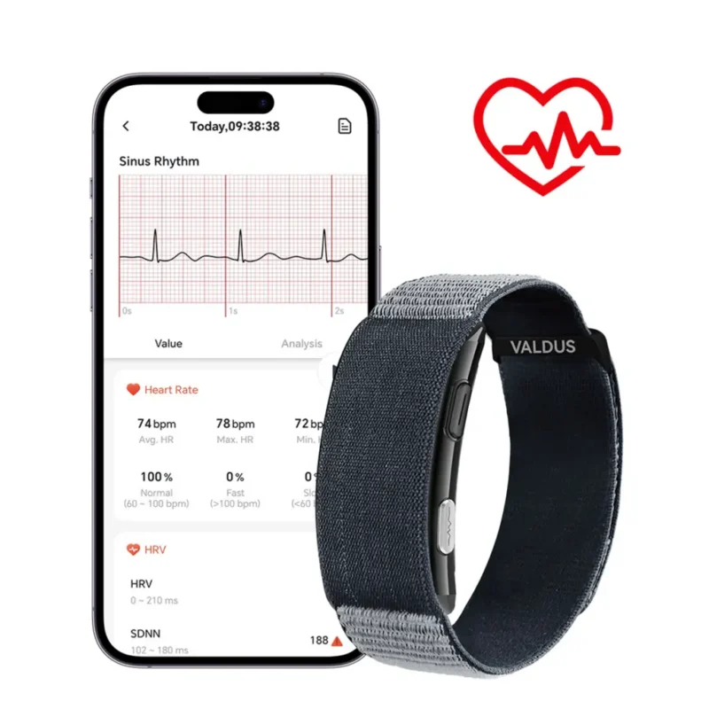 VITRO screenless ECG smartwatch with health monitoring